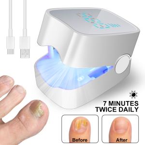 Traitement ongle LED - Fongus toenail